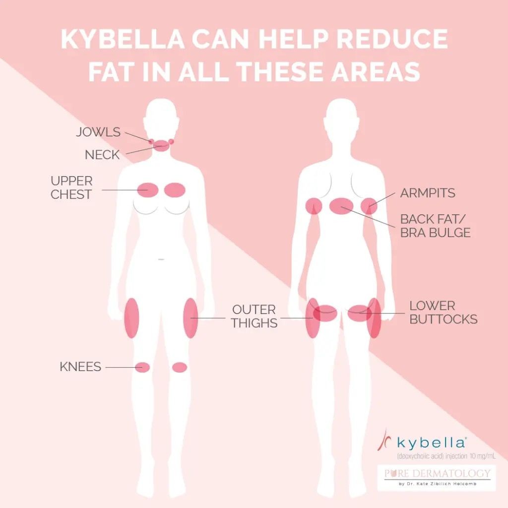 Liquid Lipo (Kybella)